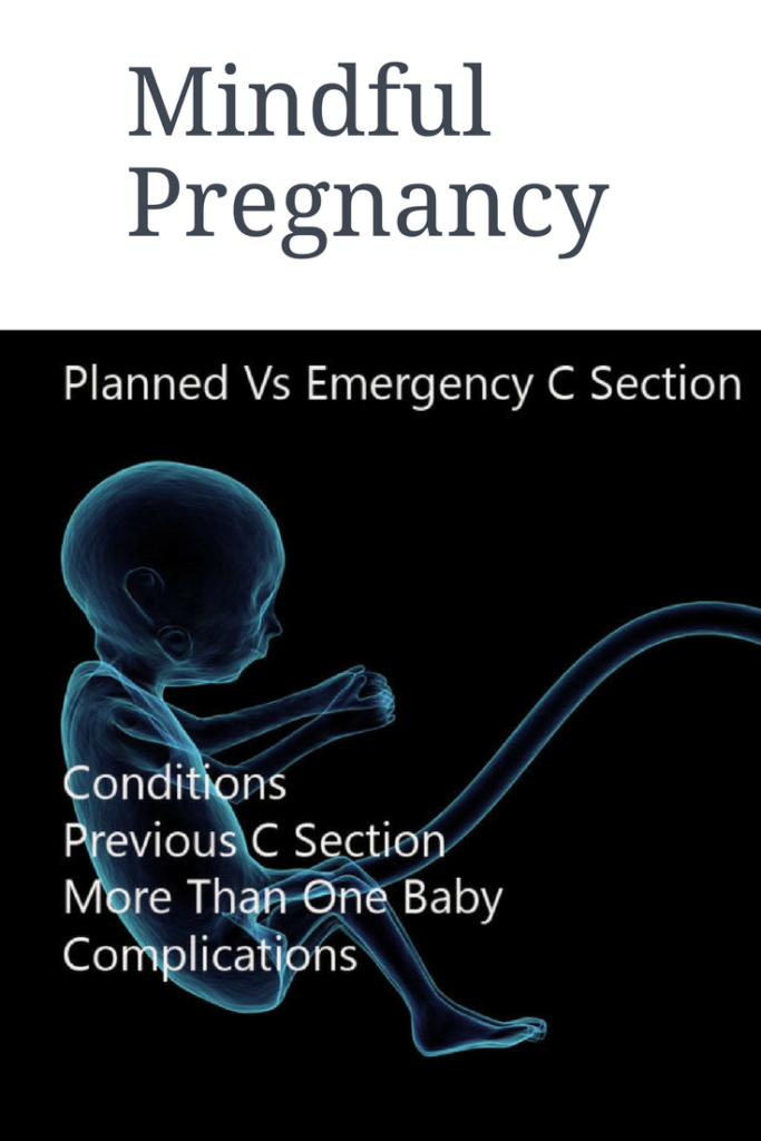 Mindful Pregnancy - Planned Vs Emergency C Section